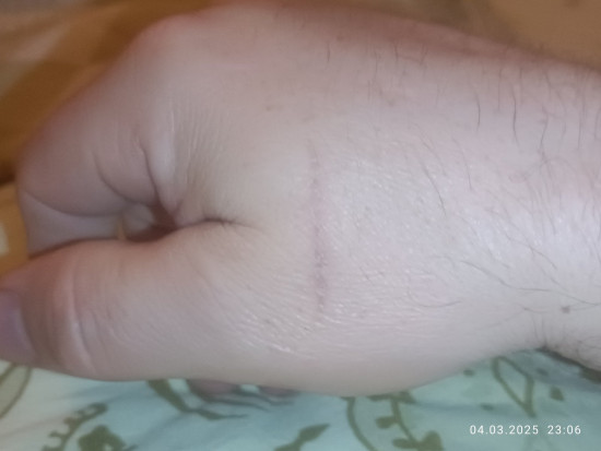 В эти выходные задел по касательной, даже не чувствуется.